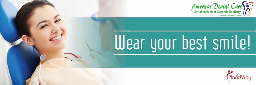 Dental Veneers in San Jose, Costa Rica
